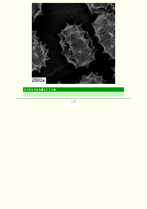 ［電子顕微鏡画像］ダルマギクの花粉2000倍